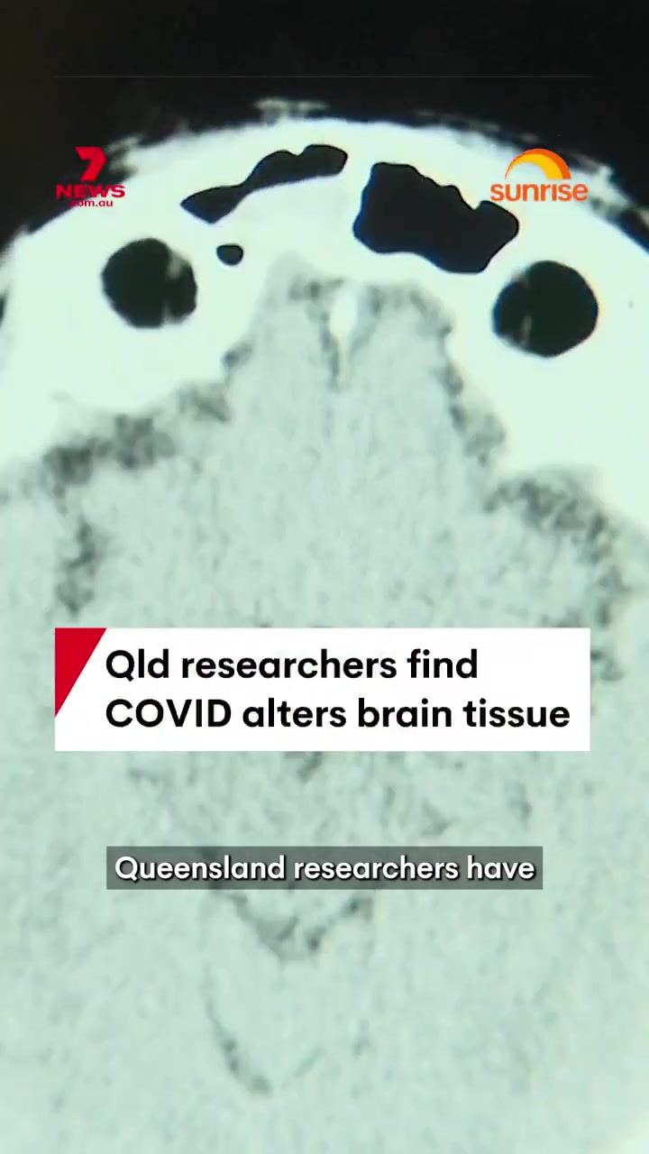 covid vaccines cause major brain damage… every vaccinated person is becoming insane like rabies… and they’re shedding…